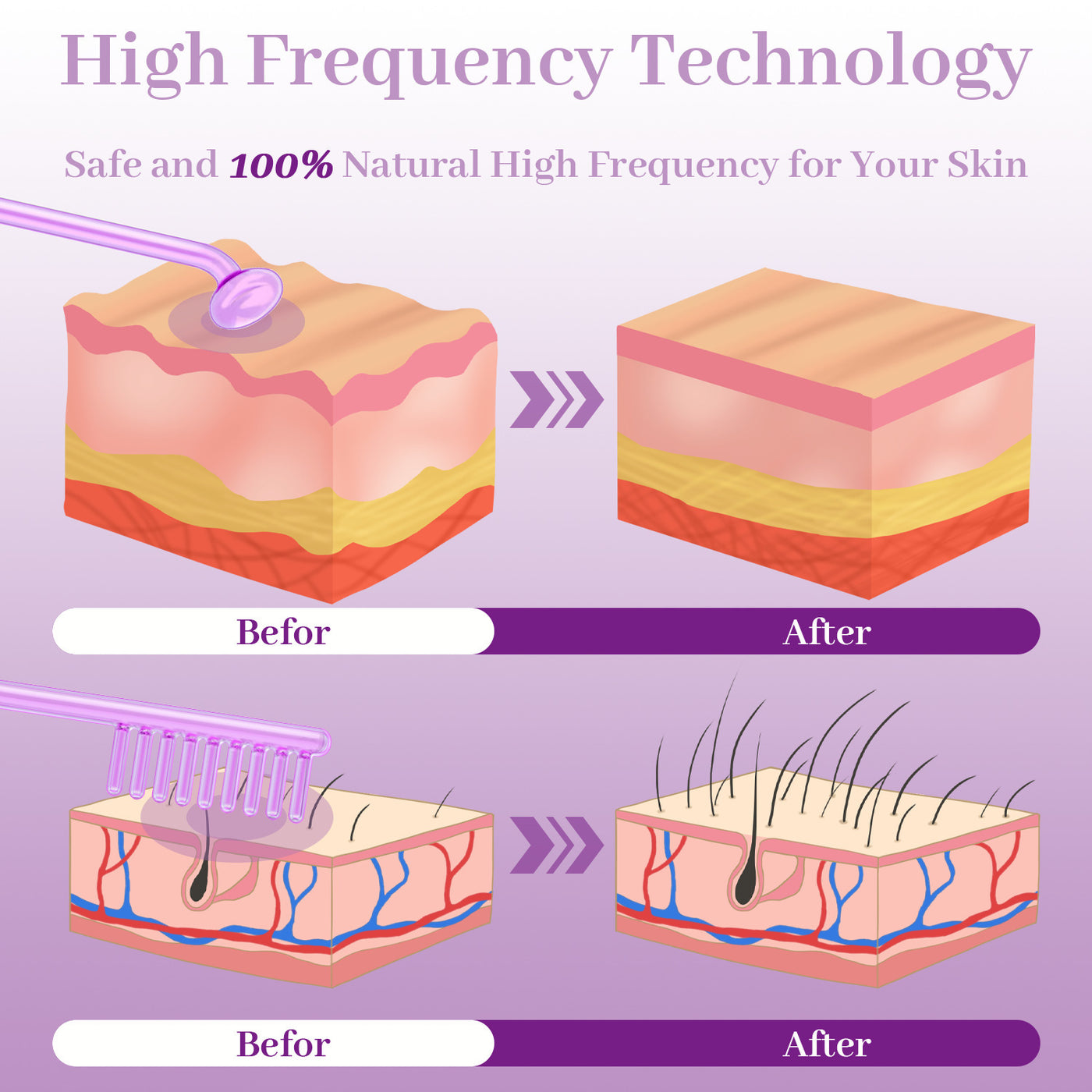 High Frequency Skin Care Device